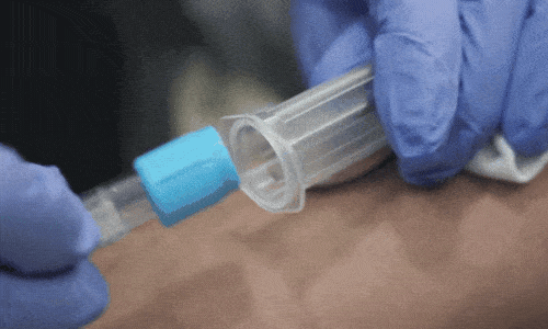 Forcells - Draw Blood sample