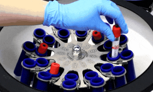 Forcells Skin Cells Concentration Centrifuge