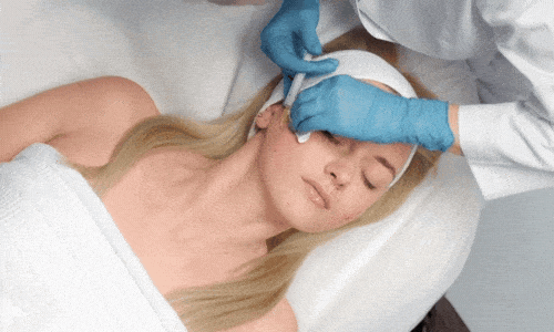 Forcells Skin Cells Microneedling