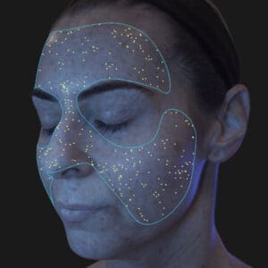 VISIA 3D - Porphyrins